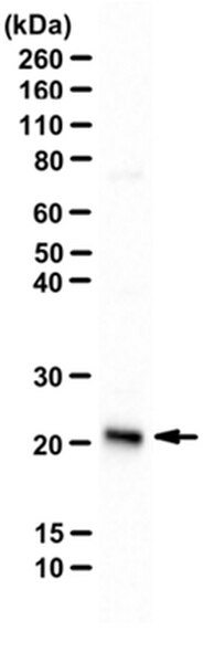 Anti-Recoverin Antibody | AB5585-I